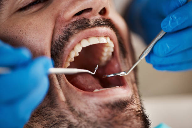 Best Periodontal (Gum) Disease Treatment  in Claremore, OK
